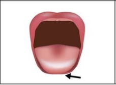 Die Zungenspitze kann über die Lippen heraus ausgestreckt werden.