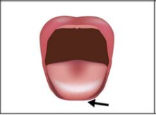 über die Lippen hinaus